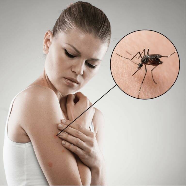 Почему вас кусают комары – 7 причин