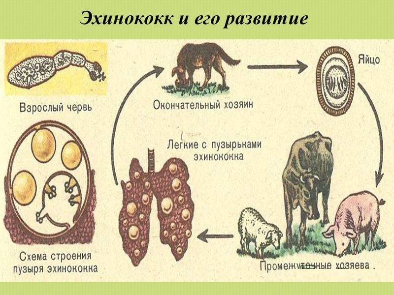 Эхинококкоз легких презентация