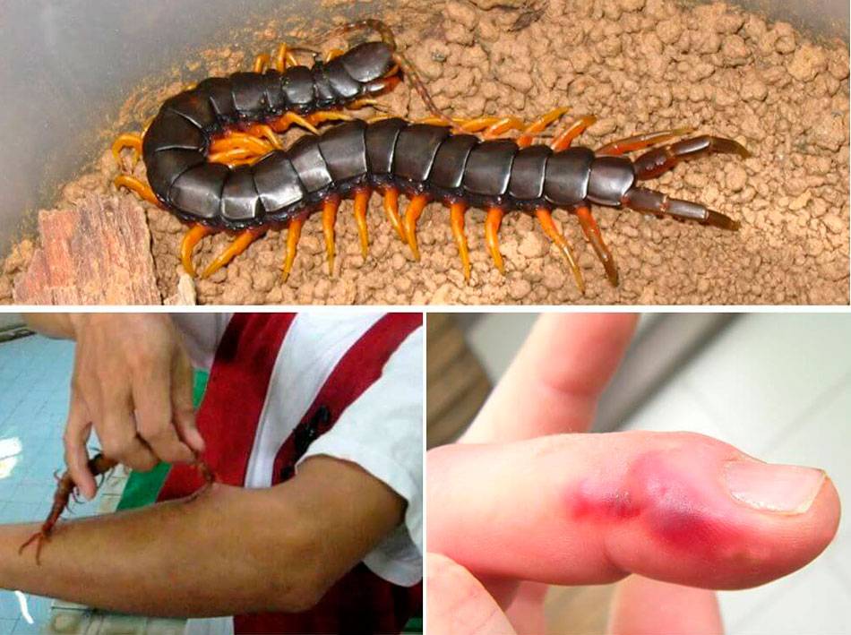 Сколопендра: фото насекомого, чем опасна, что делать после укуса