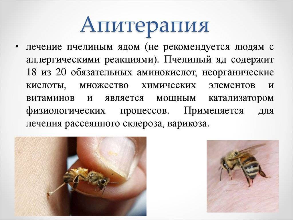 Подробные схемы точек ужаливания в апитерапии (в домашних условиях) | апитерапия.ru