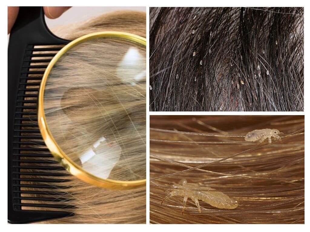 Как вычесать гнид с длинных волос в домашних условиях