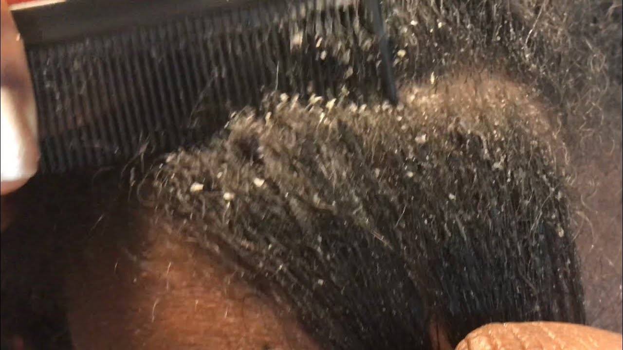 Что может щелкать в волосах