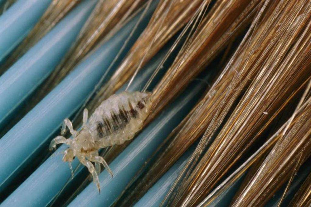 Истребитель головных насекомых или как вывести вшей керосином в домашних условиях