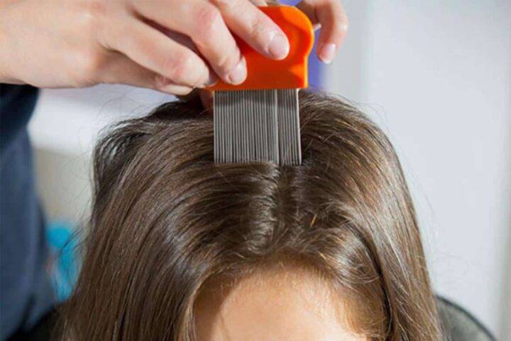 Как вычесать гнид с длинных и коротких волос в домашних условиях