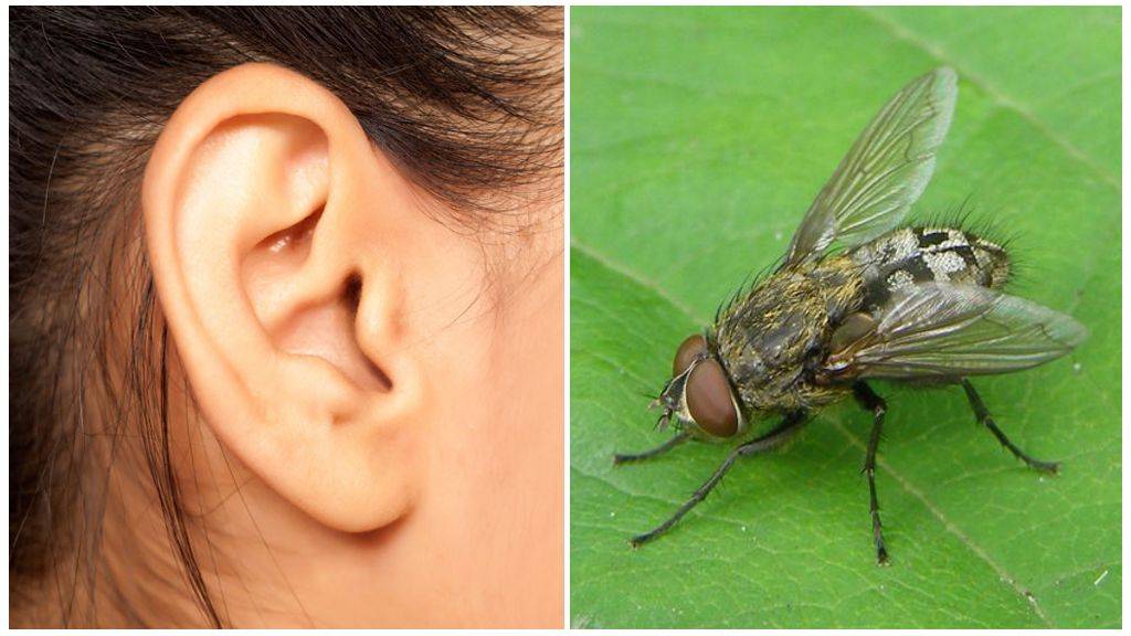 Что делать, если комар залетел в ухо