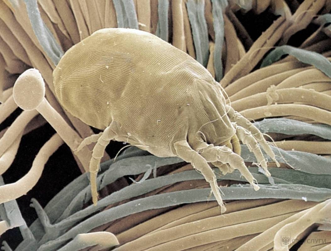 Пылевые (dermatophagoides) постельные клещи – 10 фото, описание, жизненный цикл, места обитания. 12 средств и способов избавления от клещей самостоятельно в домашних условиях