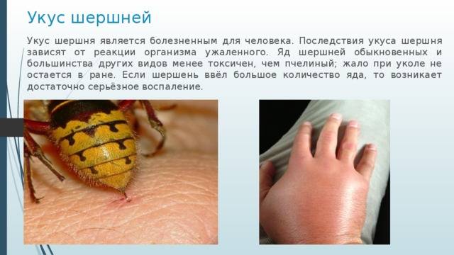 Укус шершня и его последствия для человека