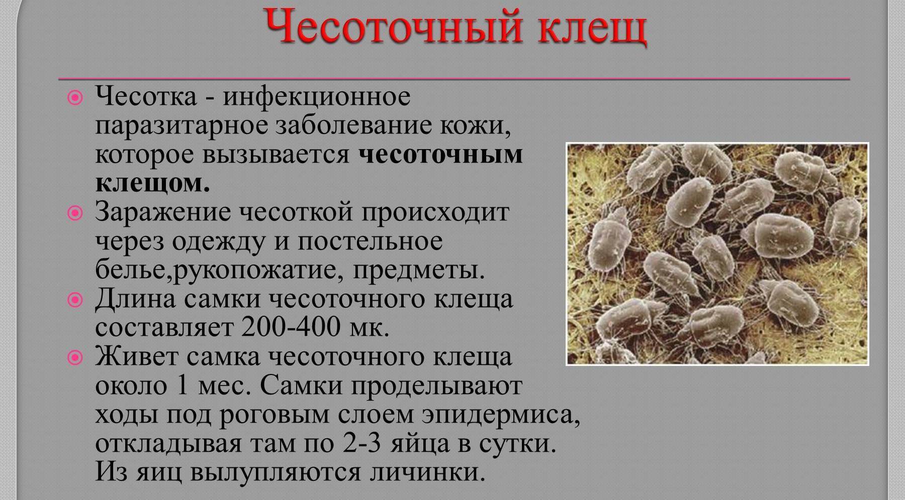 Чесотка: причины, симптомы, диагностика и лечение