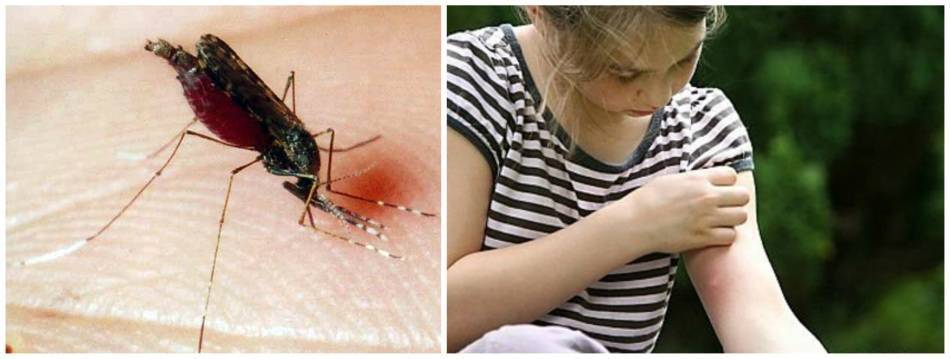 Укус малярийного комара: симптоматика и способы лечения